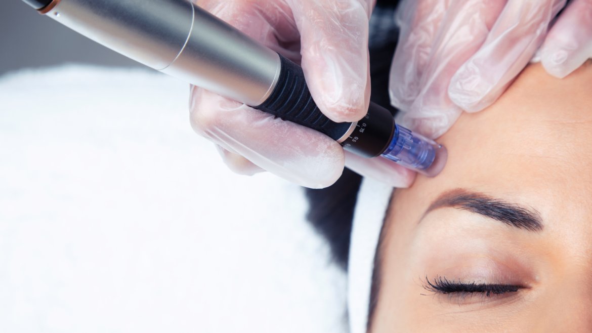 PRX-T33 & Microneedling – Skin Regeneration for Face & Neck